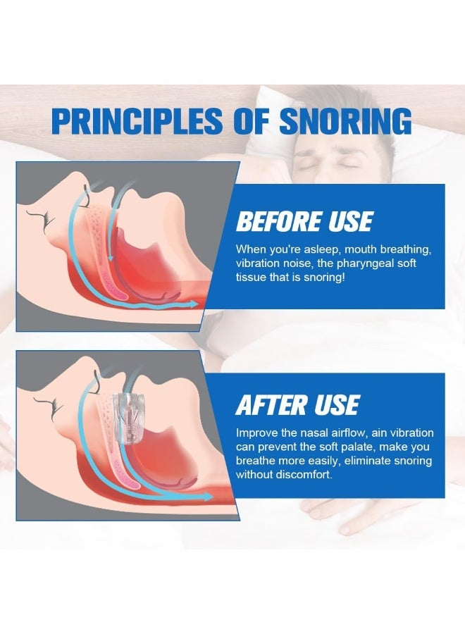 Adjustable Anti Snoring Devices, Anti Snore Mouth Guard, Anti Snoring Mouthpiece, Snoring Solutions Comfortable Snoring Aids for Men Women, Reusable Anti Snore Devices - Image 5